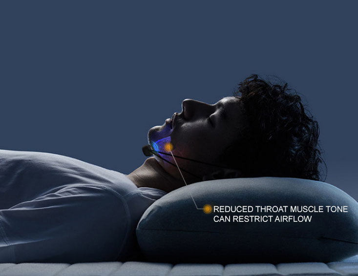 Smart Throat Anti-Snoring Device - Upsell