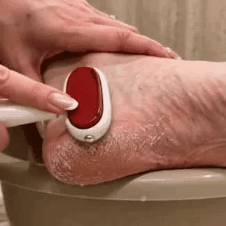 Dual-Sided Stainless Steel Foot Scraper for Calluses & Cracked Heels