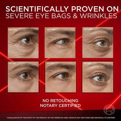 Eye Bag Eraser — Instantly Refreshes, Firms & Smooths for a Youthful Look That Lasts 8 Hours