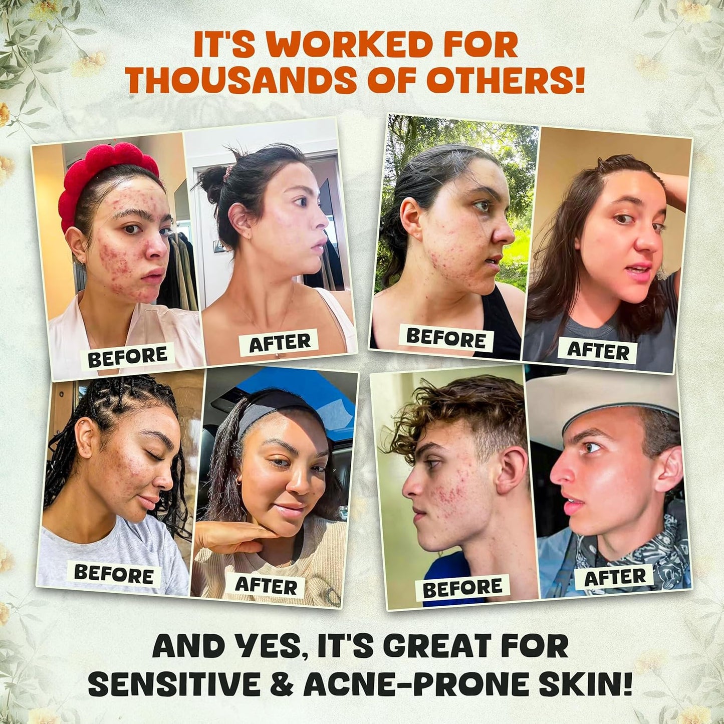 Whipped Tallow & Manuka Honey Moisturizer